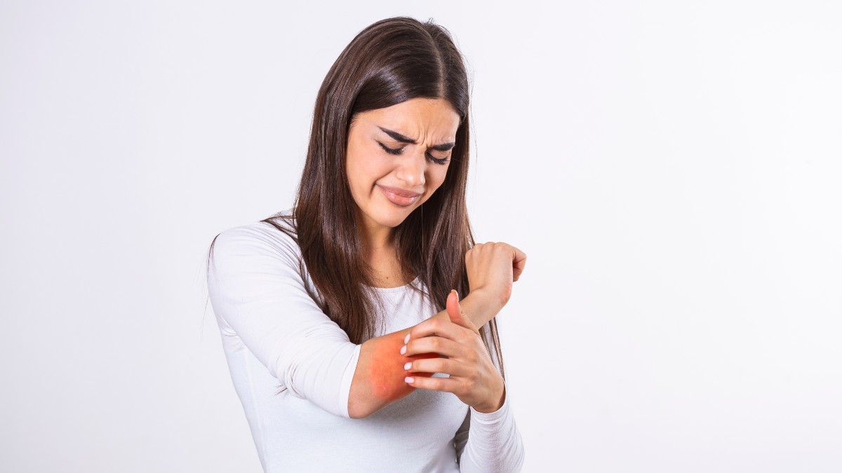 1899397507 skin psoriasis jpg