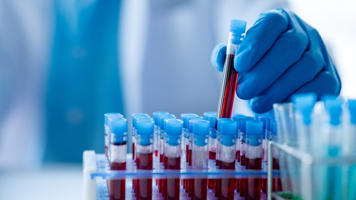 2248148893 blood jpg