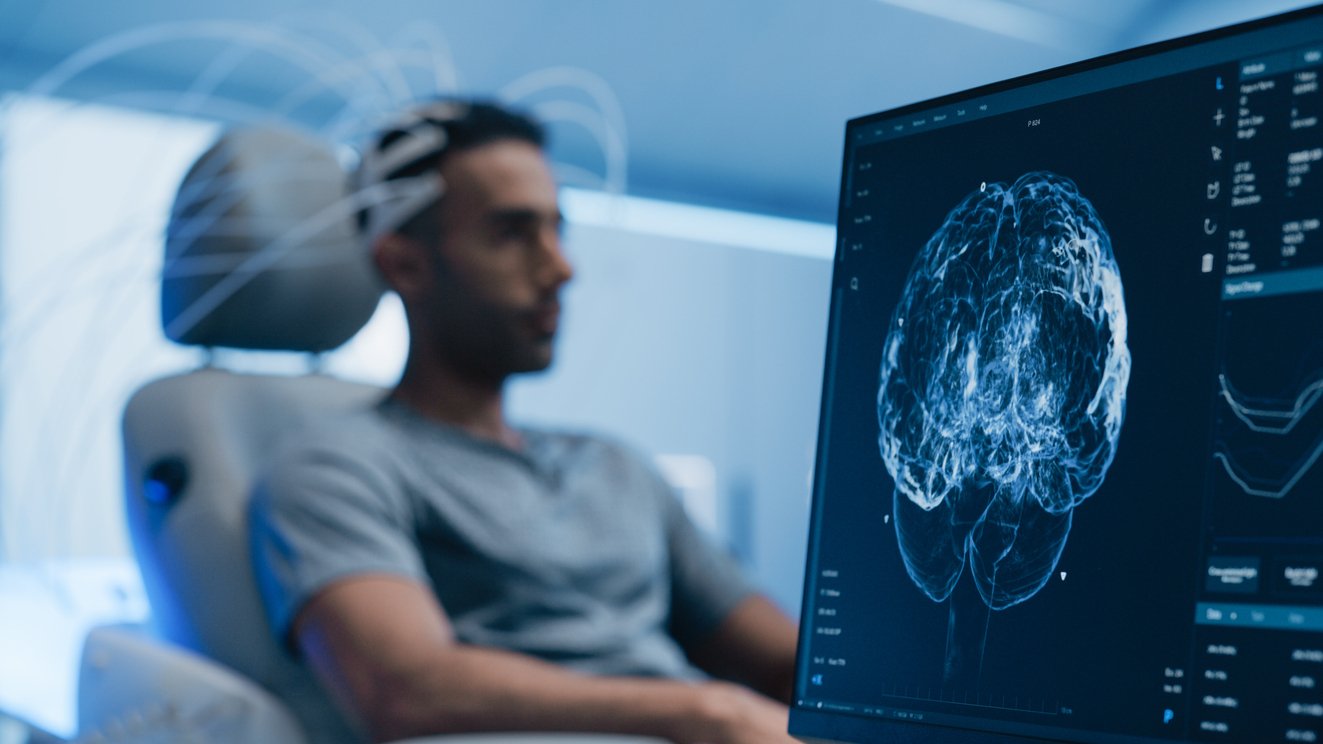 brain scan iStock 2198730408 jpg
