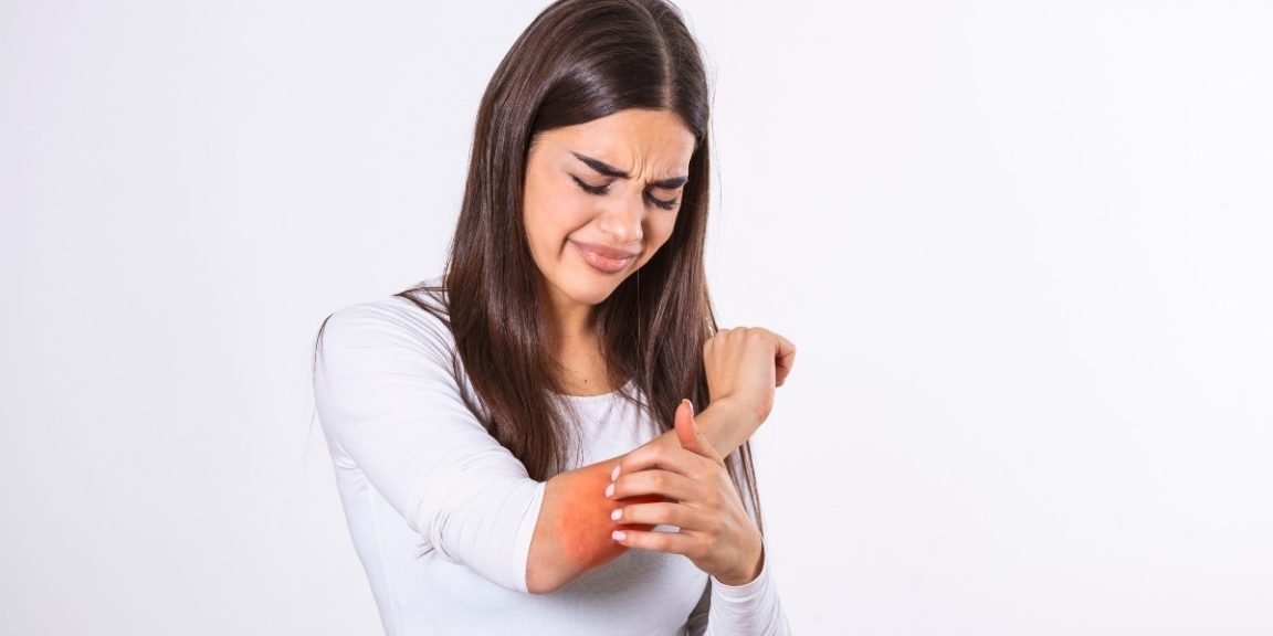 1899397507 skin psoriasis jpg