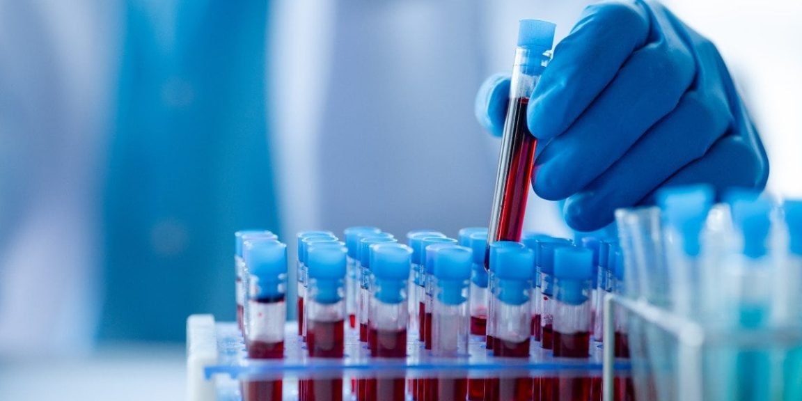 2248148893 blood jpg