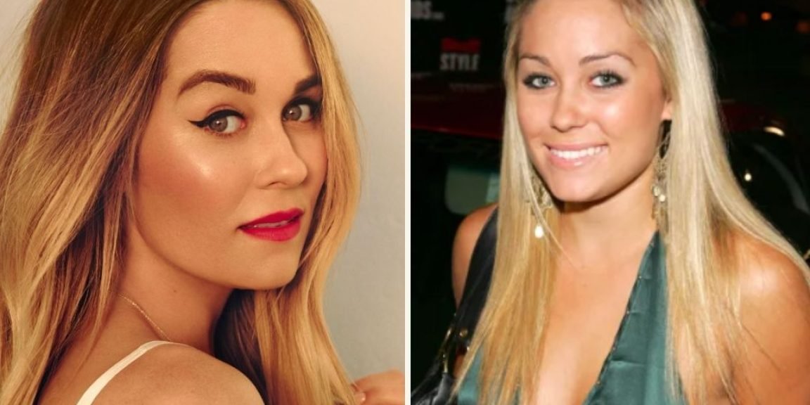 Lauren Conrad emfanisi diatrofi jpg