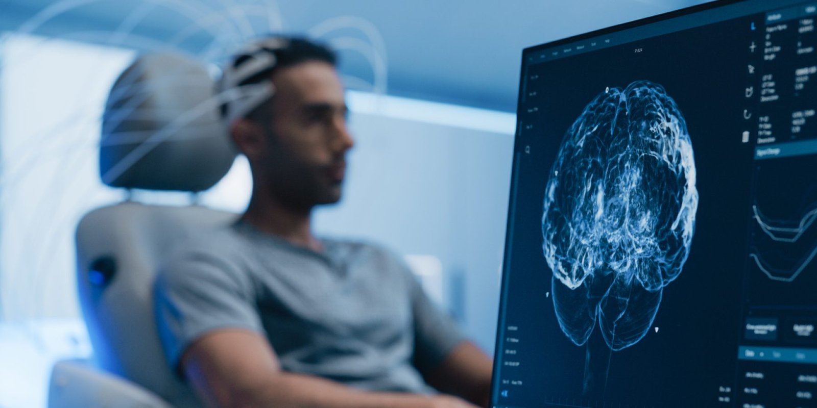 brain scan iStock 2198730408 jpg