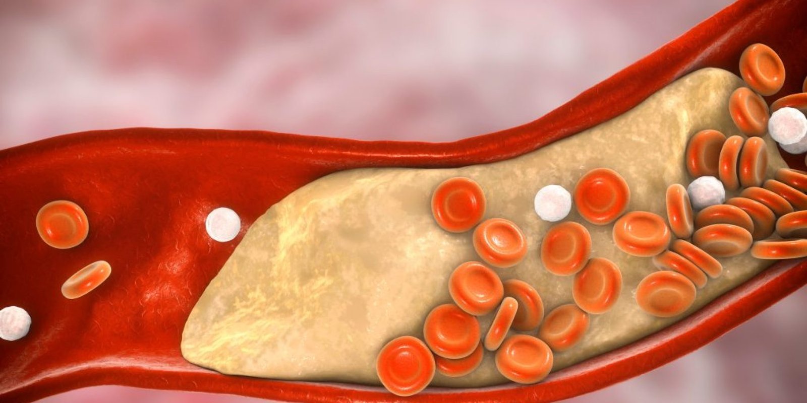 cholisterini therapeia 1024x683 jpg