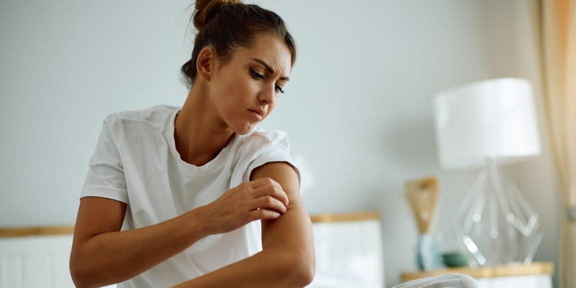 itchy skin shutterstock 2528367969 jpg