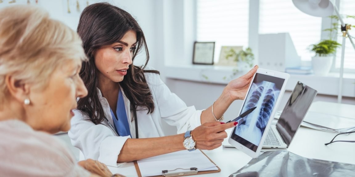 lung cancer doctor shutterstock 2184021869 jpg
