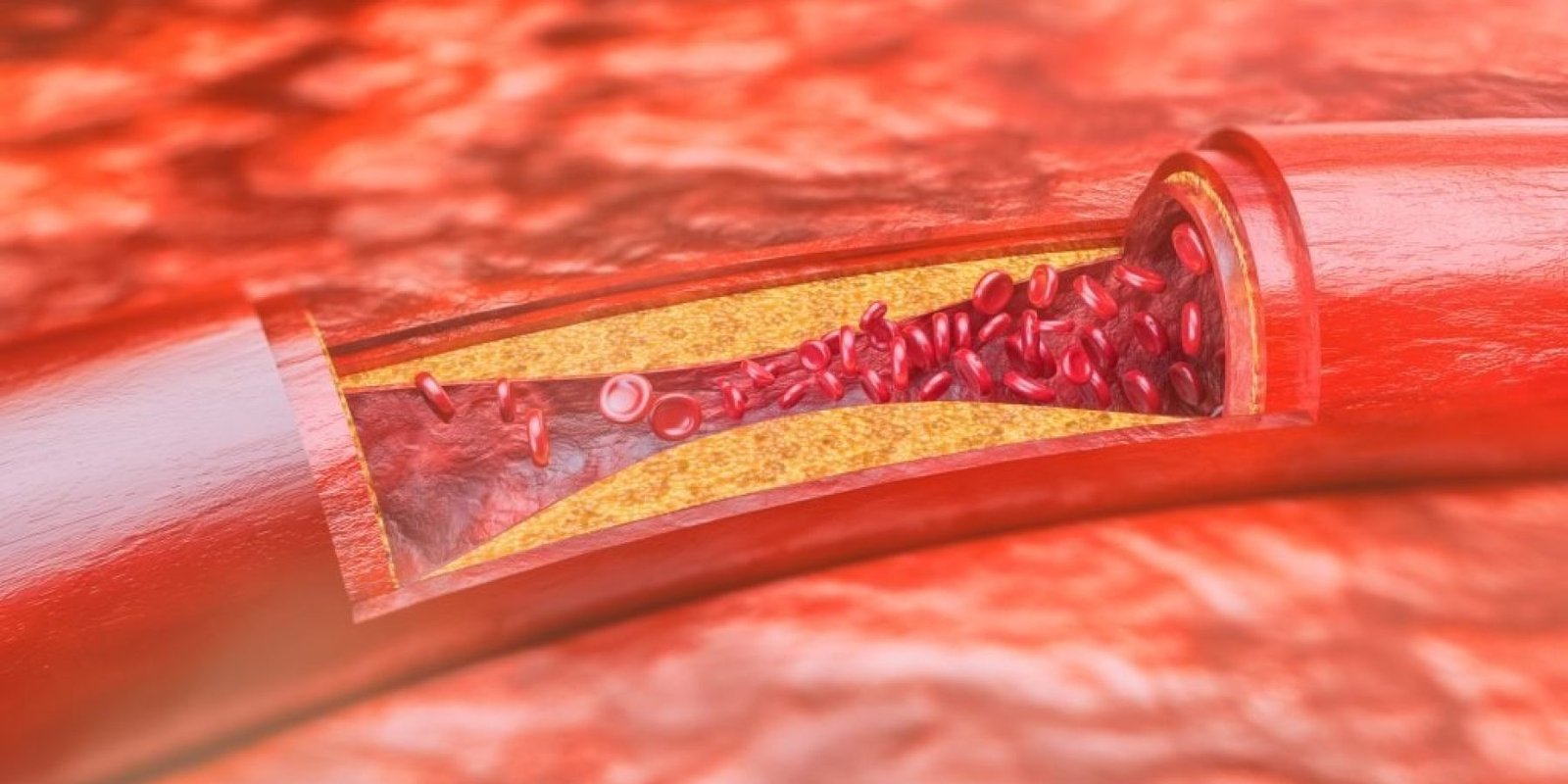 score asvestioy akriveia kardiako 1024x569 jpg