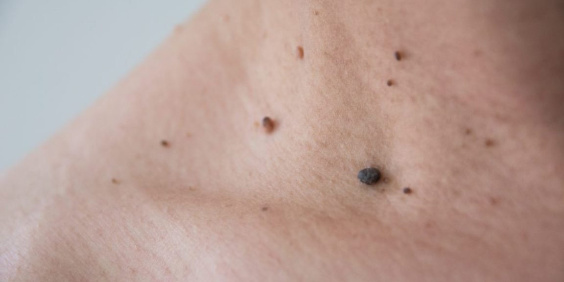 thilomata prokaloyn afairoyntai 1024x683 jpg