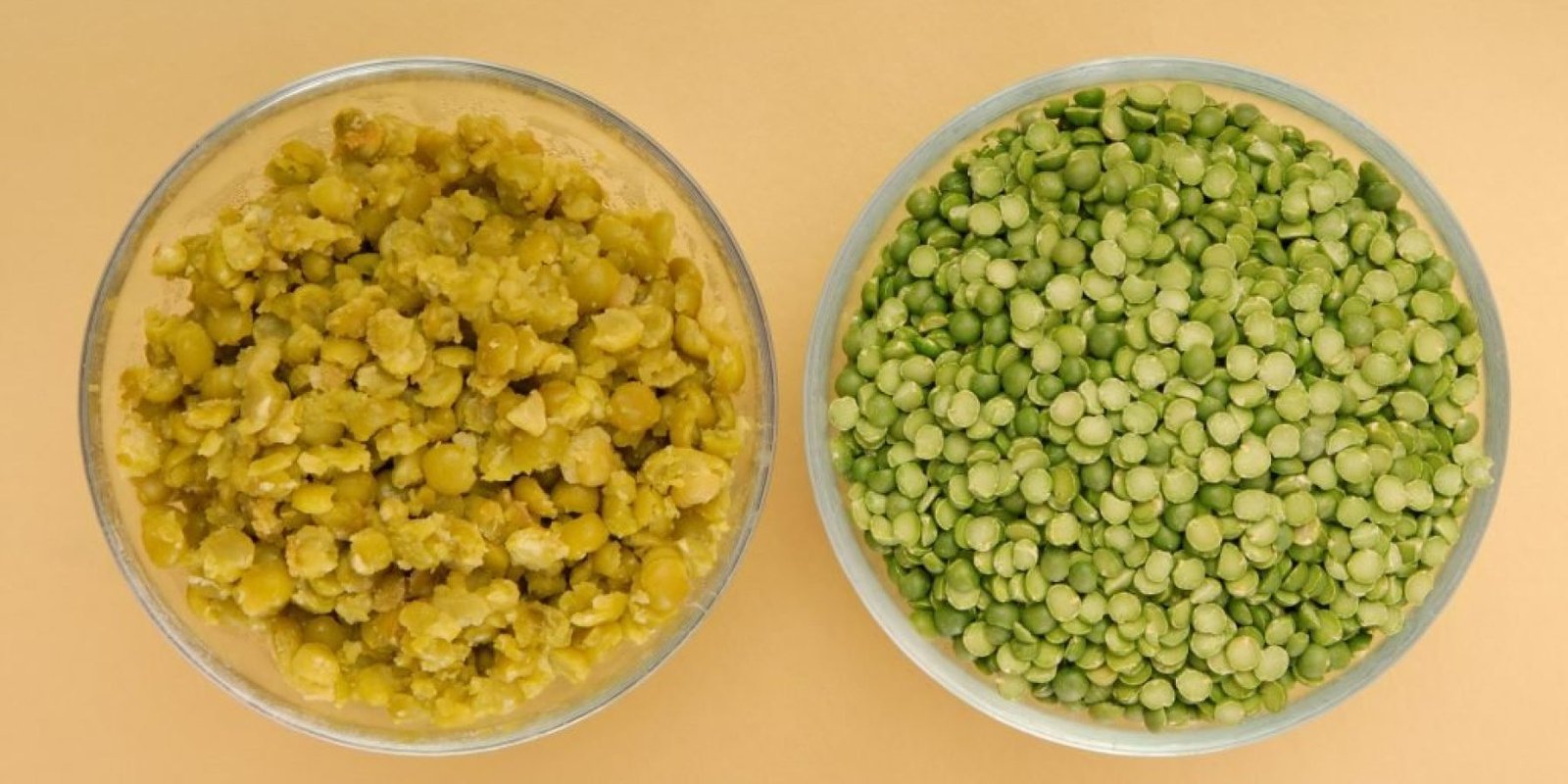 ypertrofi santorinis piesi cholisterini 1024x686 jpg