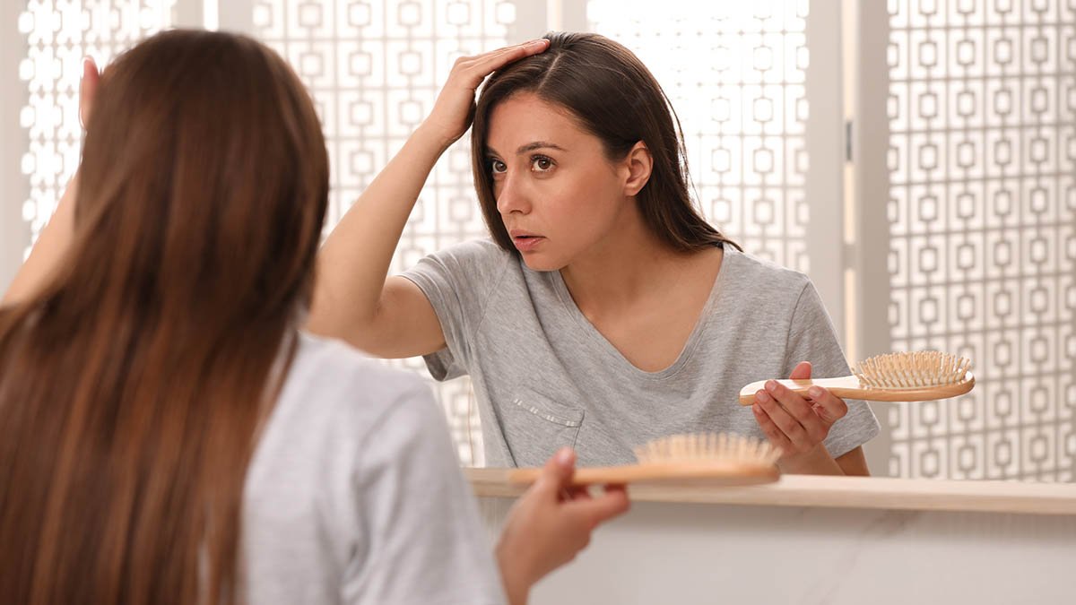 hairloss 1993151240 jpg