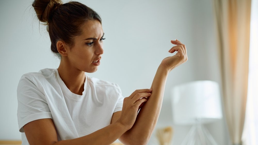 kounoupi itchy shutterstock 2541854783 jpg