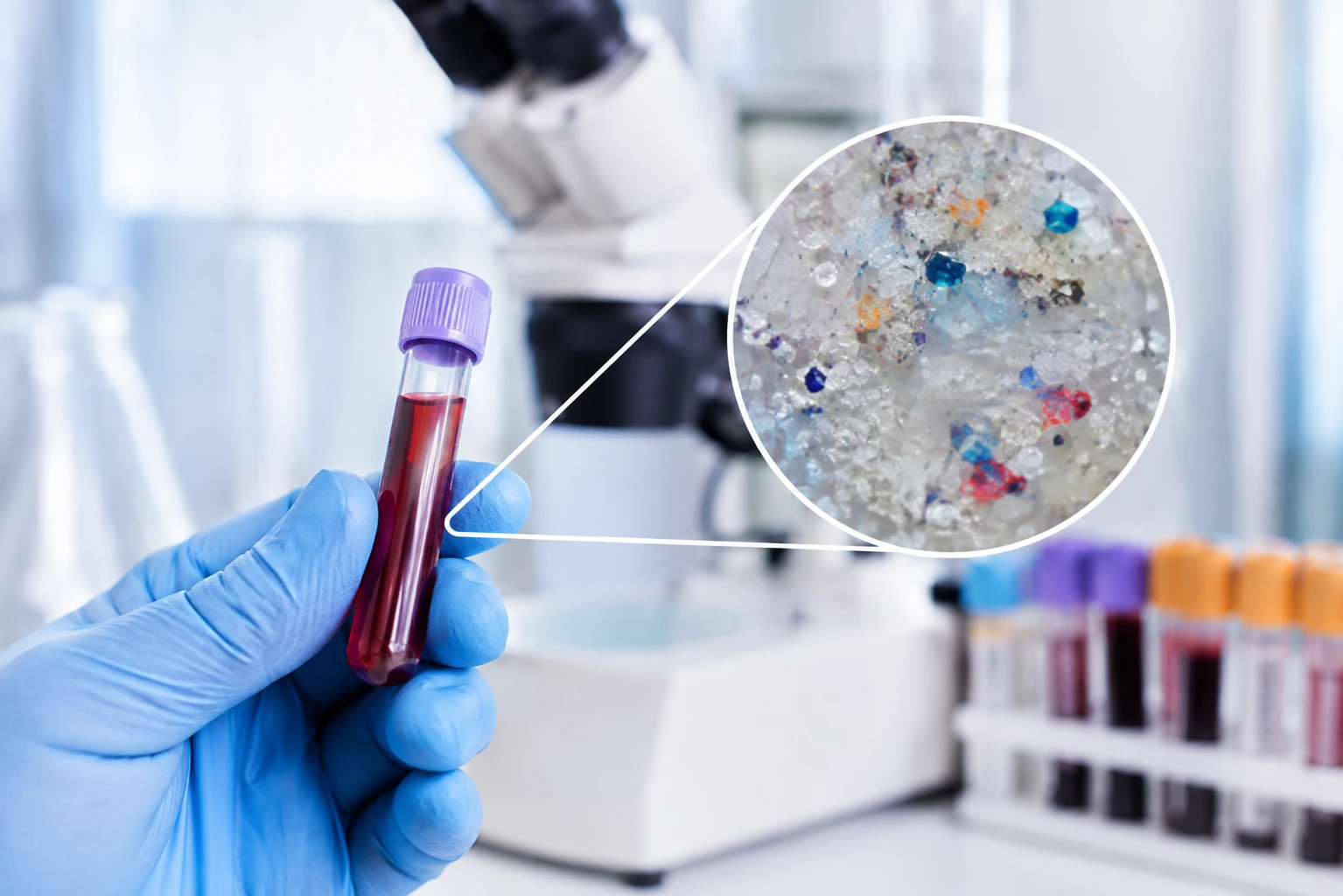 mikroplastika kardia webp