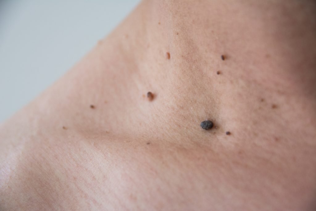 thilomata prokaloyn afairoyntai 1024x683 jpg